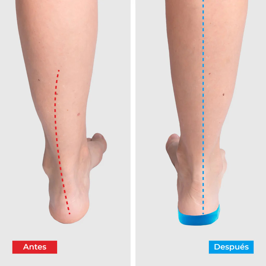 Plantilla AcuBalance™️ -El secreto oriental que alivia tu dolor al caminarsin pastillas, sin terapias, sin excusas.